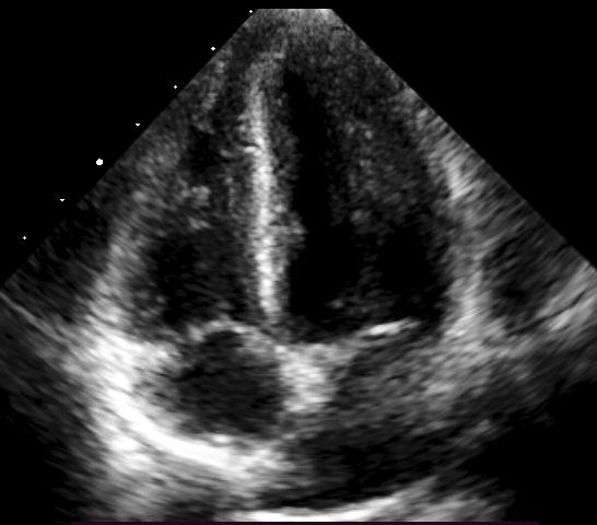 ecocardiografia cardiología pediátrica Arequipa